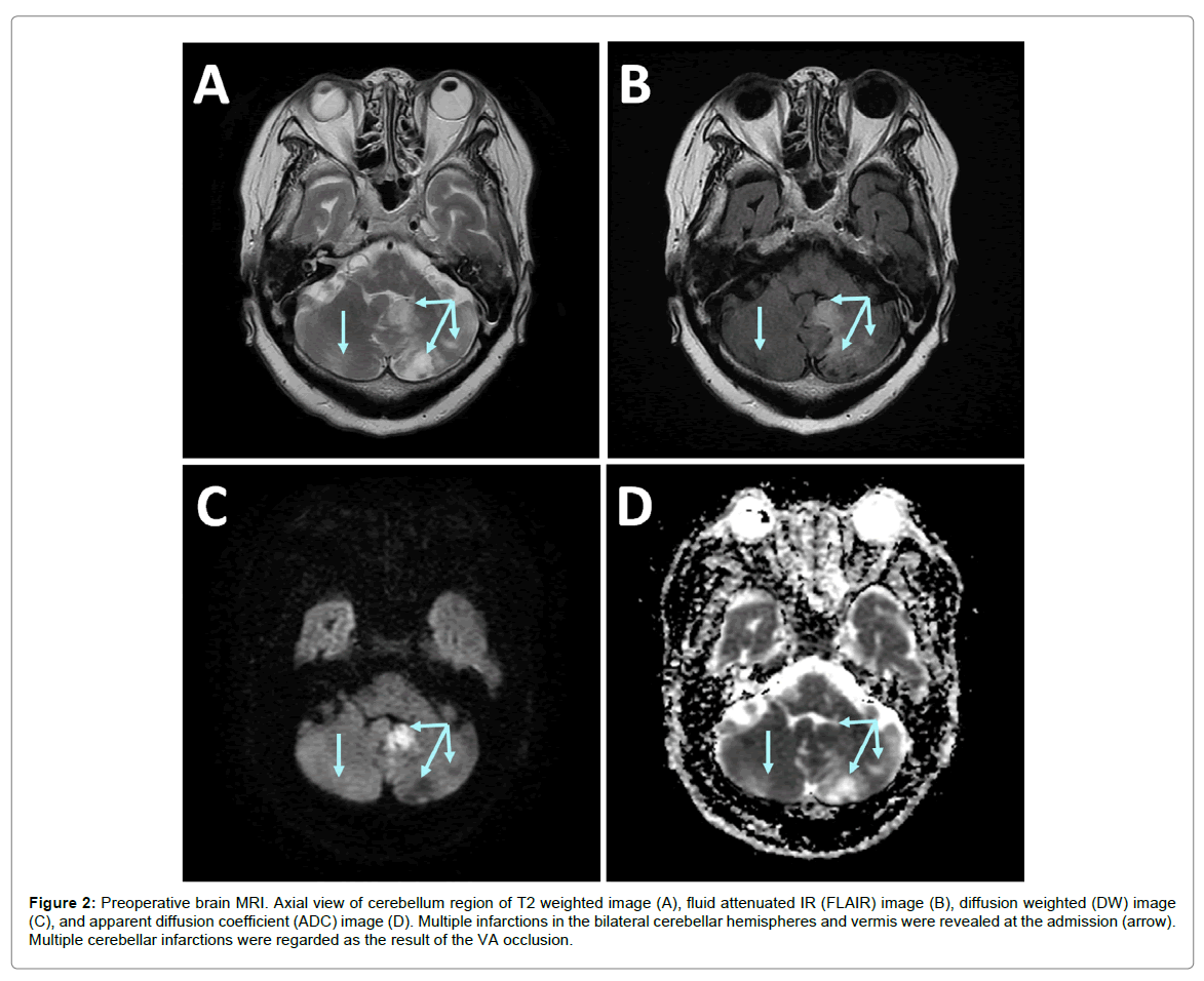 radiology-cerebellum-region