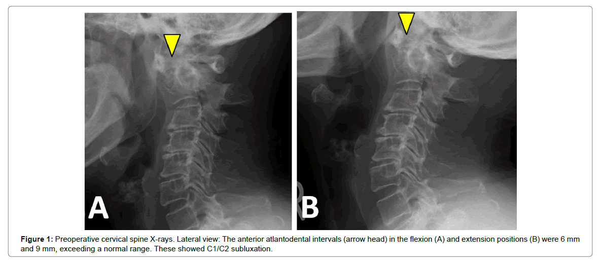 radiology-cervical-spine