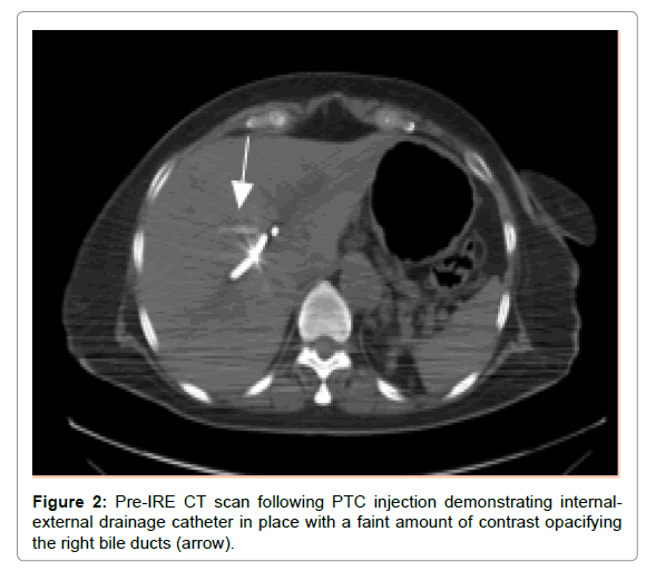 radiology-contrast-opacifying