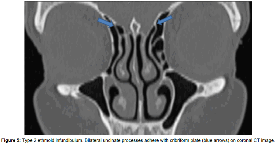 radiology-coronal-CT-image