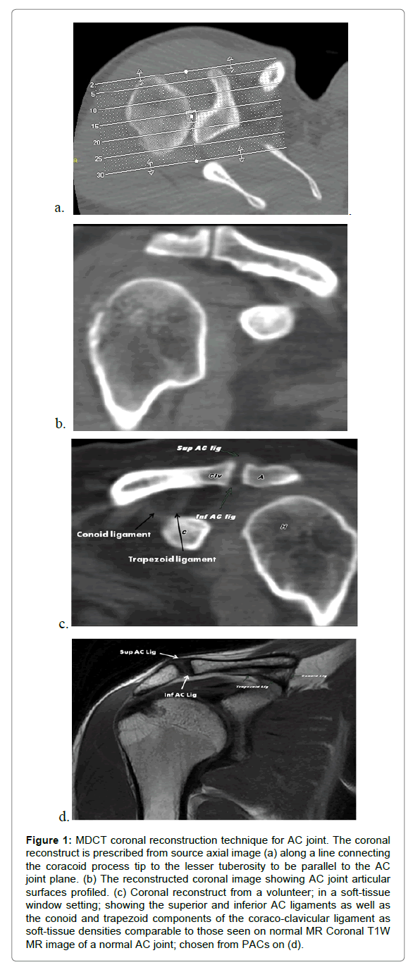 radiology-coronal-reconstruction