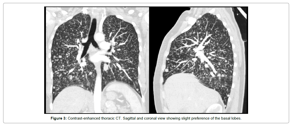 radiology-coronal-view
