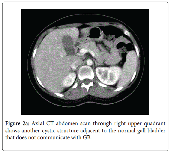 radiology-cystic-structure