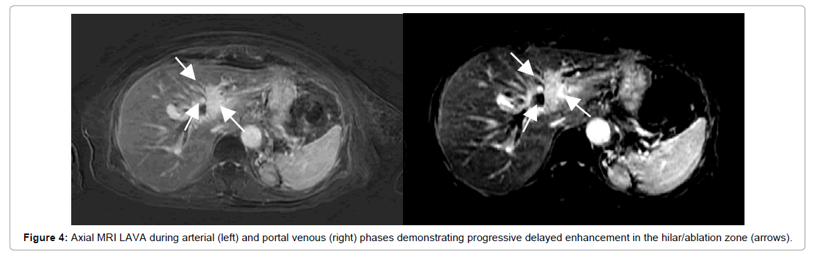 radiology-during-arterial