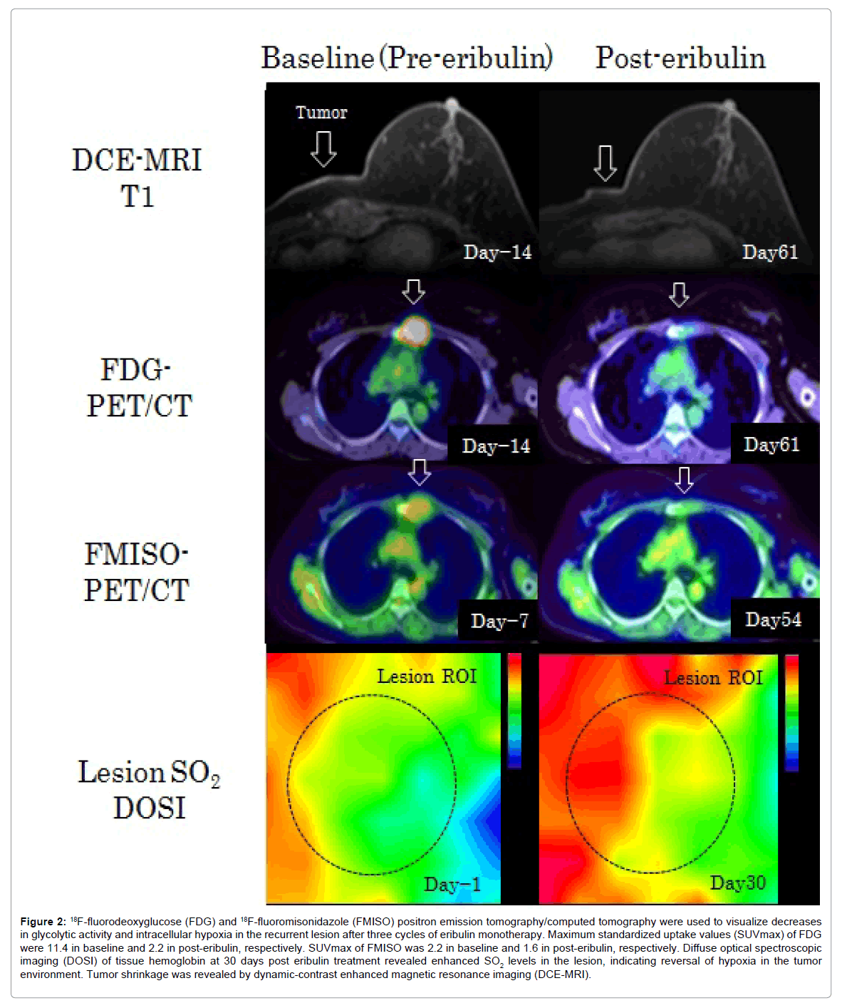 radiology-fluorodeoxyglucose