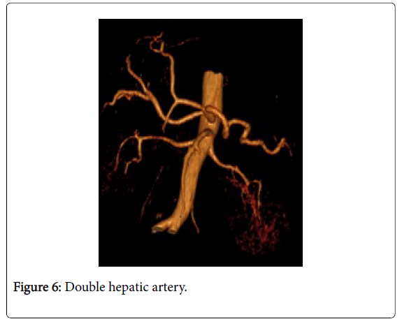 radiology-hepatic-artery