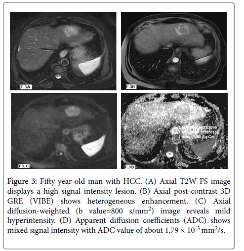 radiology-intensity-lesion
