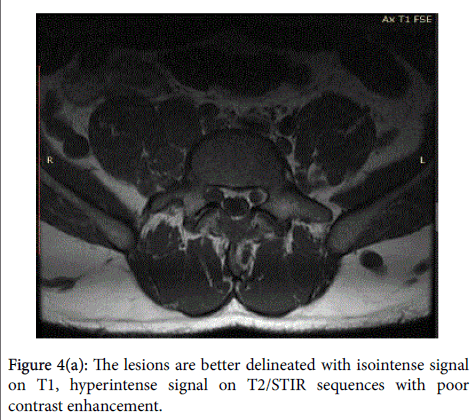 radiology-isointense-signal