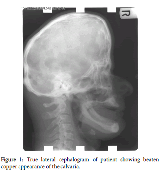 radiology-lateral-cephalogram-patient
