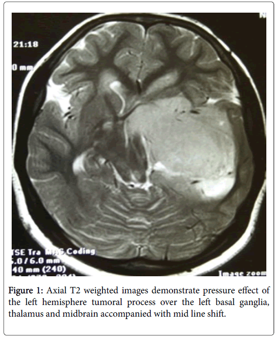 radiology-line-shift