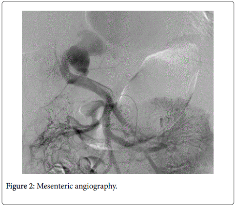 radiology-mesenteric-angiography