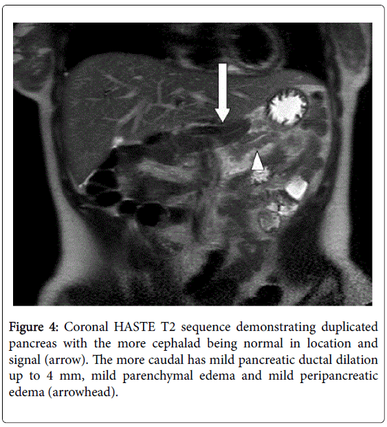 radiology-mild-peripancreatic