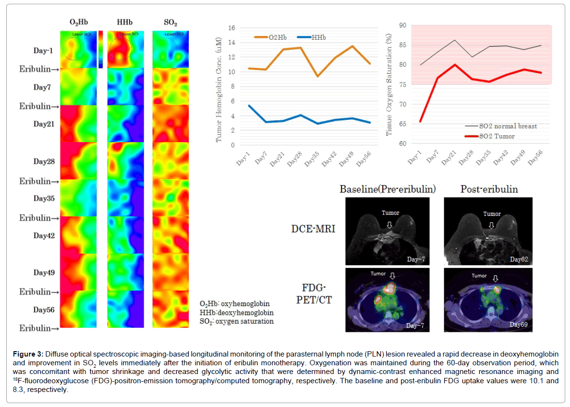 radiology-optical-spectroscopic