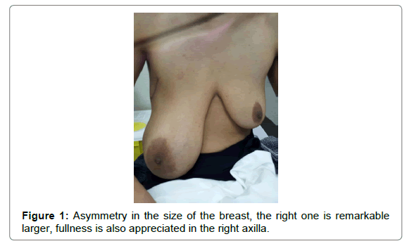 radiology-right-axilla