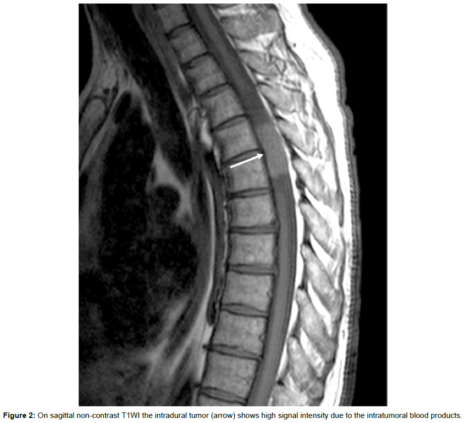 radiology-sagittal-non-contrast