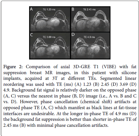 radiology-suppression-breast-MR-images