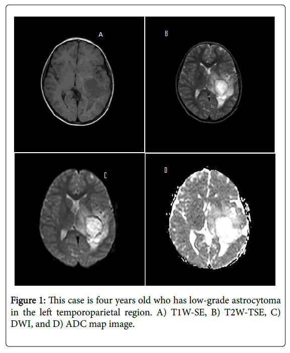 radiology-temporoparietal-region