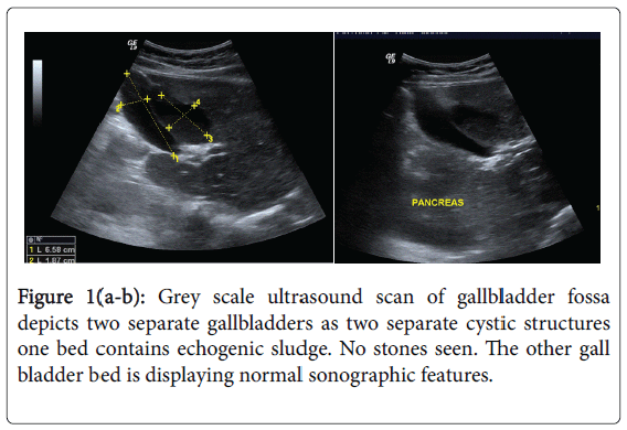 radiology-ultrasound-scan