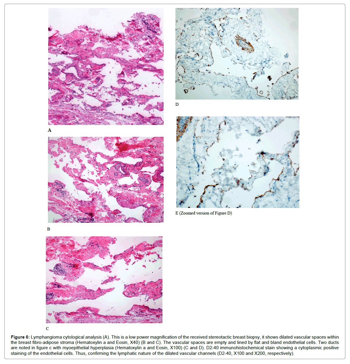 radiology-vascular-channels