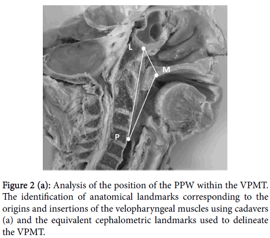 speech-pathology-therapy-Analysis-position