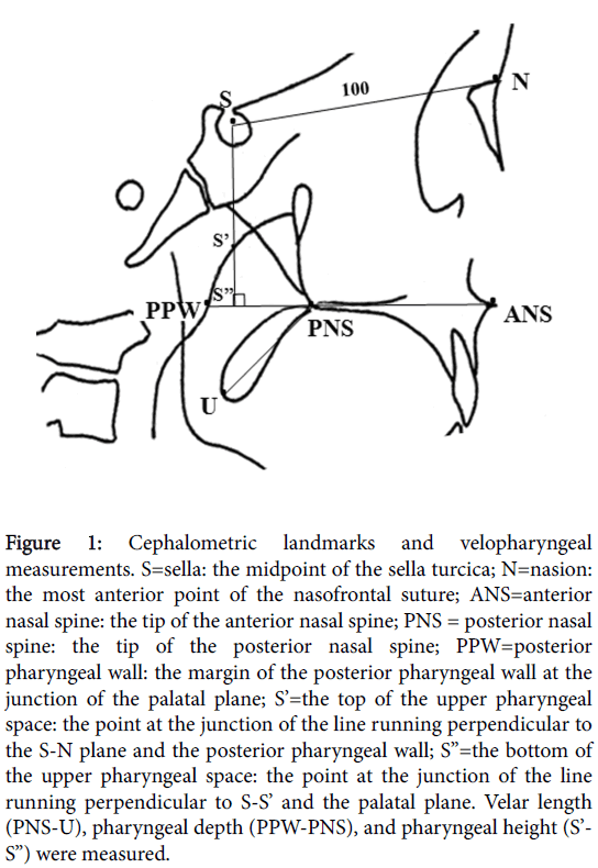 speech-pathology-therapy-Cephalometric-landmarks