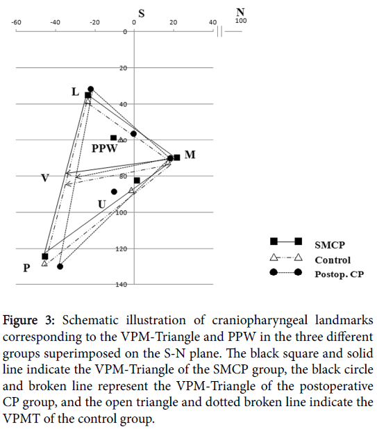 speech-pathology-therapy-Schematic-illustration
