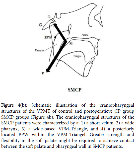 speech-pathology-therapy-control-postoperaticve