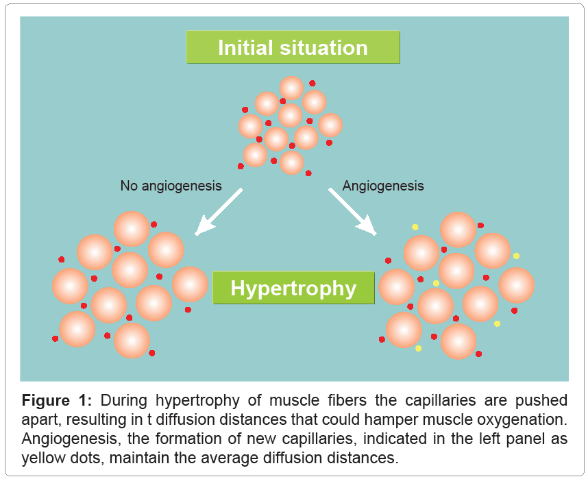 determinants of skeletal muscle hypertrophy and the attenuated