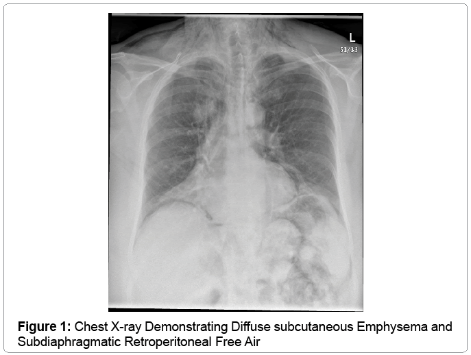 Abdominal Xray Startradiology Abdominal Xray Startradiology