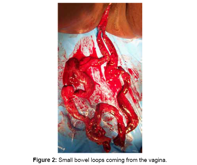 El aborto daña a la mujer - Página 10 Surgery-current-research-loops-2-118-g002