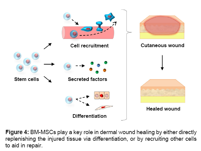 What is Regenerative Healing? - Russell Health