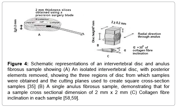 biomechanism profile of intervertebral discs ivd strategies to