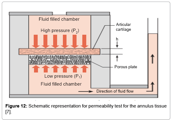 Nachemson Chart