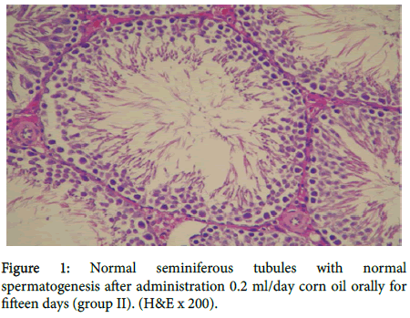 toxicology-Normal-seminiferous