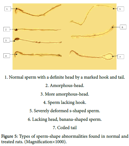 toxicology-sperm-shape-abnormalities