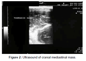 mediastinal lymphosarcoma