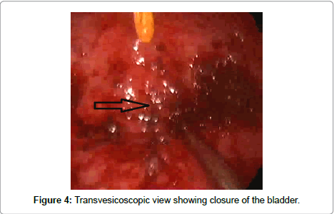 womens-health-care-closure-bladder