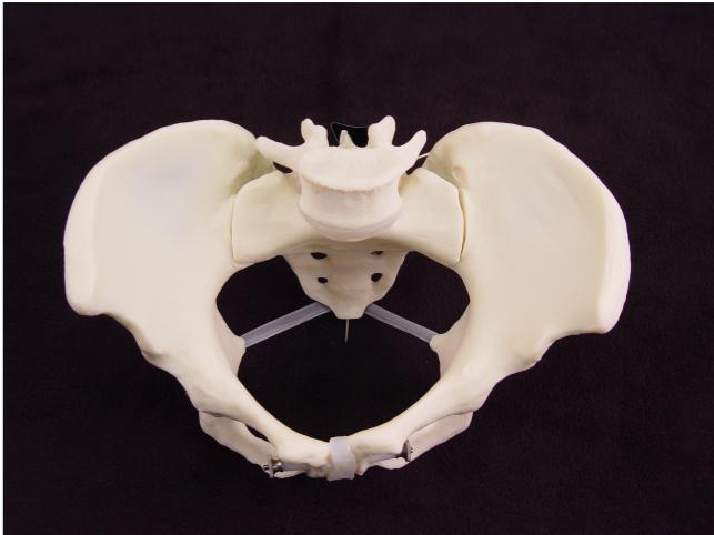 ischial spine ischial spine