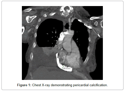 cardiac-pulmonary-chest