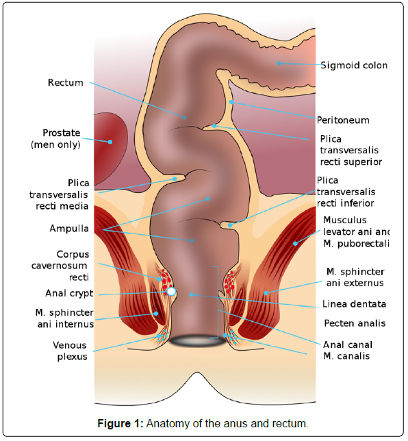 Clinical Pharmacology & Biopharmaceutics - Rectal Drug Delivery System: An  Overview