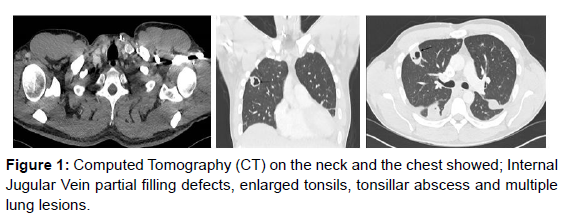 journal-radiology-tomography