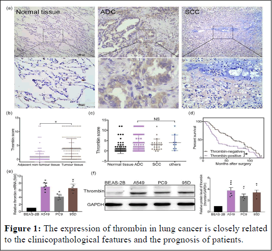 ijrdpl-patients ijrdpl-patients
