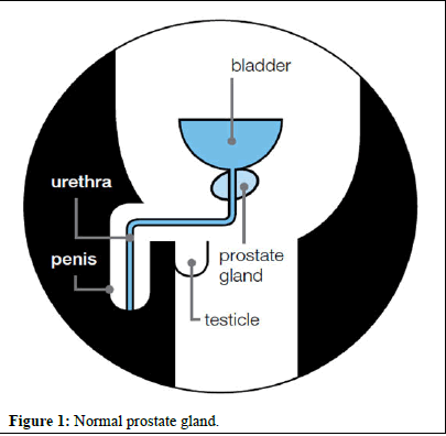 omha-normal omha-normal