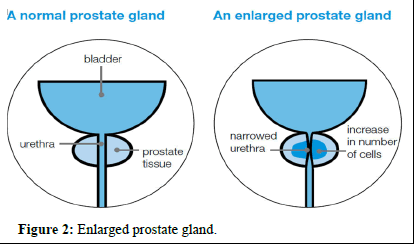 omha-normal omha-normal