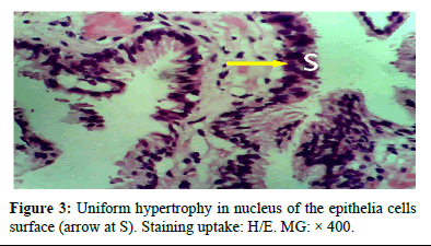 omha-normal omha-normal