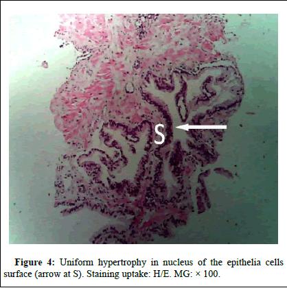 omha-normal omha-normal