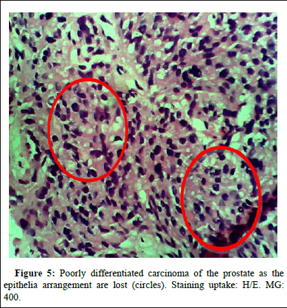 omha-normal omha-normal