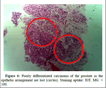 omha-normal omha-normal