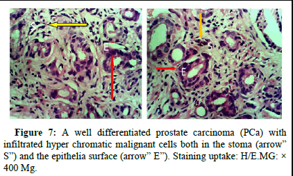 omha-normal omha-normal