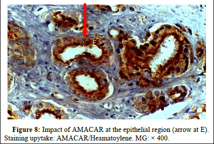 omha-normal omha-normal
